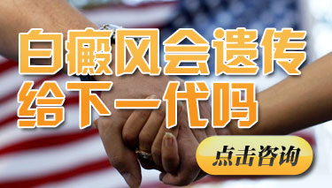 白癜风的出现会不会遗传给下一代