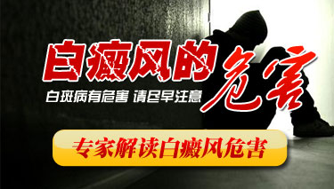 白癜风病情扩散后有什么危害